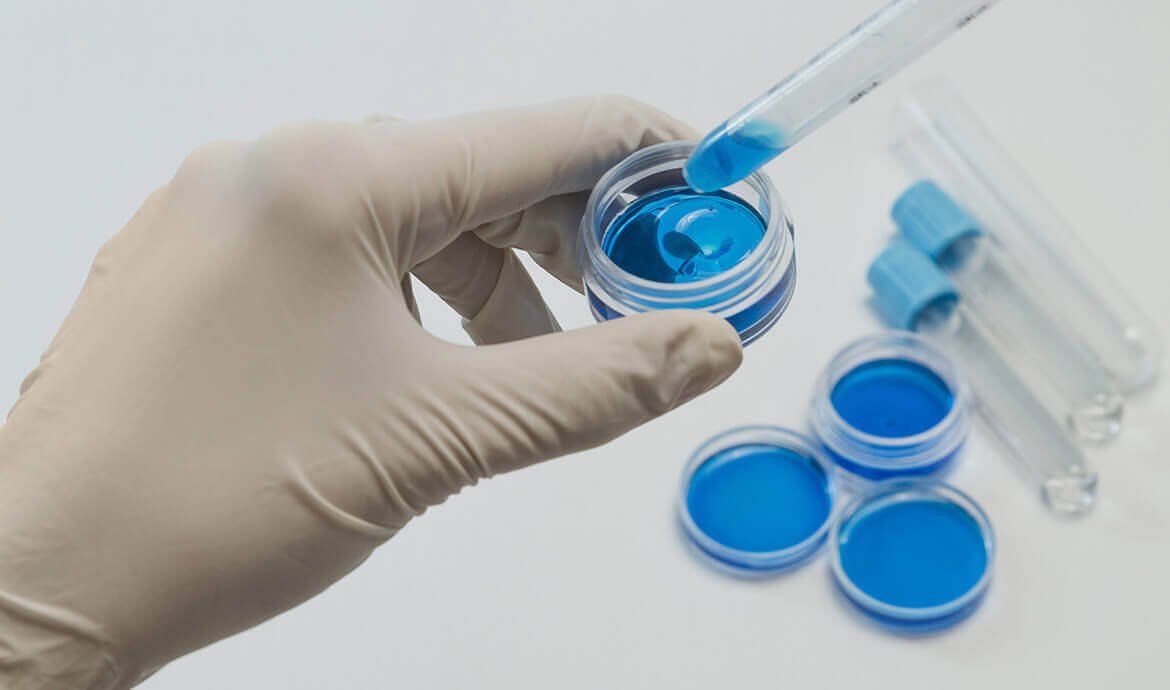 Naturalne Sposoby na Siniaki: Jak Szybko Pozbyć się Bólu i Przebarwień?