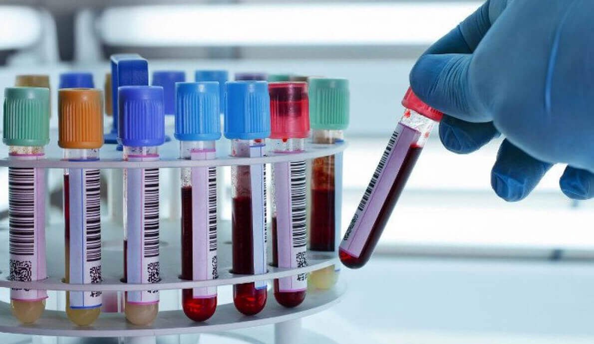 Profesjonalne pobranie próbki krwi w nowoczesnym laboratorium diagnostycznym - klucz do profilaktyki zdrowotnej.